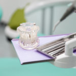 View at model dentures in dental office